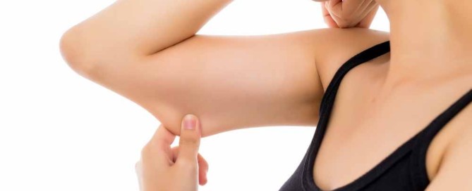 flacidez en los brazos