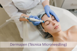 Dermapen Técnica Microneedling, Centro Dermoestético Las Canteras, La Laguna