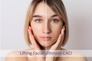 Lifting Facial Ultimate Caci tienda, Centro Dermoestético Las Canteras, La Laguna