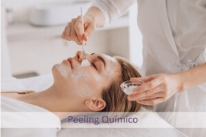 Peeling Químico -Centro Dermoestético Las Canteras