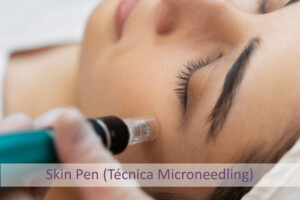 Skin Pen Técnica Microneedling, Centro Dermoestético Las Canteras, La Laguna.