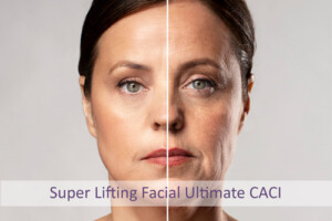 Super Lifting Facial Ultimate Caci Centro Dermoestético Las Canteras, La Laguna.