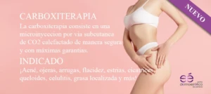 Carboxiterapia - Centro Dermoestético Las Canteras